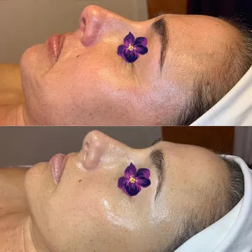 Gua Sha 195$