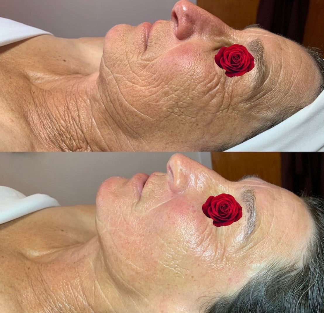 YOUTHFUL Surprise Box (wrinkles, loss of elasticity, collagen)