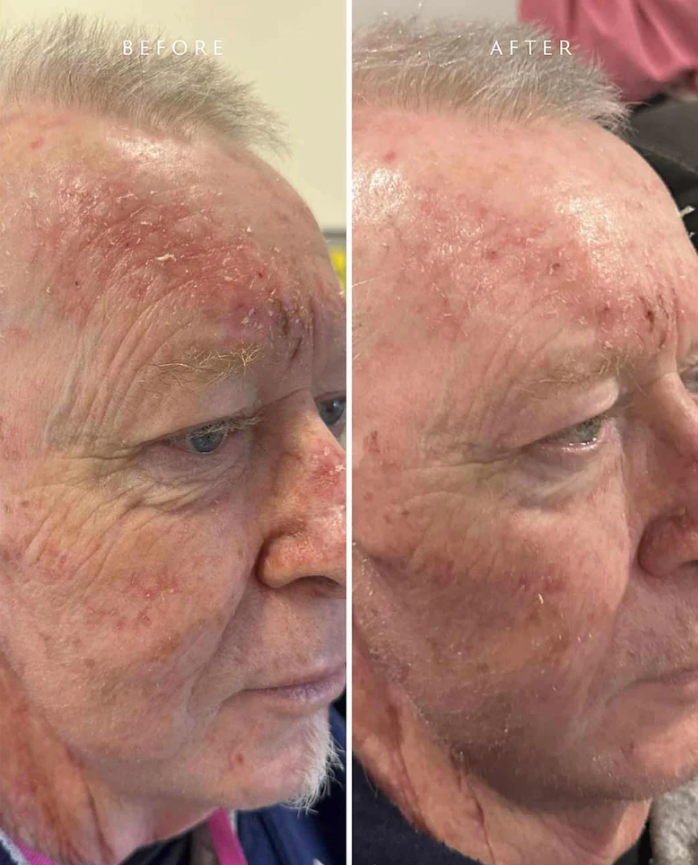 OxyLift 30ml/1 fl. oz