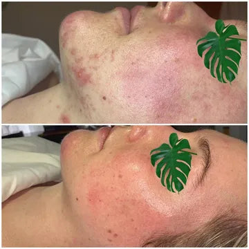 Glycoala 350$