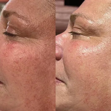 Growth Factor facial 165$